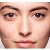 „Mini Skin“ viso padengimo maskuoklis